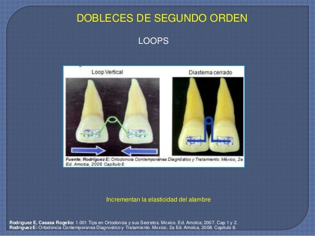 Movimientos dentales