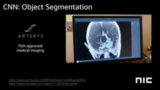 FDA-approved
medical imaging
https://www.periscope.tv/AWSstartups/1vAGRgevBXRJl
https://www.youtube.com/watch?v=WE81dncwnIc
CNN: Object Segmentation
 