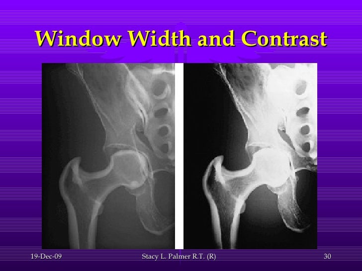 Moving from analog to digital 2.0