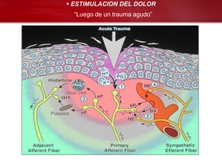  ESTIMULACION DEL DOLOR
  “Luego de un trauma agudo”
 