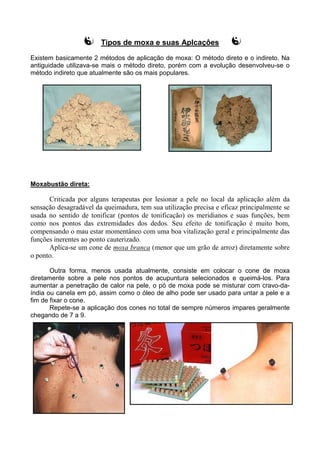 Tipos de moxa e suas Aplcaçôes
Existem basicamente 2 métodos de aplicação de moxa: O método direto e o indireto. Na
antiguidade utilizava-se mais o método direto, porém com a evolução desenvolveu-se o
método indireto que atualmente são os mais populares.
Moxabustão direta:
Criticada por alguns terapeutas por lesionar a pele no local da aplicação além da
sensação desagradável da queimadura, tem sua utilização precisa e eficaz principalmente se
usada no sentido de tonificar (pontos de tonificação) os meridianos e suas funções, bem
como nos pontos das extremidades dos dedos. Seu efeito de tonificação é muito bom,
compensando o mau estar momentâneo com uma boa vitalização geral e principalmente das
funções inerentes ao ponto cauterizado.
Aplica-se um cone de moxa branca (menor que um grão de arroz) diretamente sobre
o ponto.
Outra forma, menos usada atualmente, consiste em colocar o cone de moxa
diretamente sobre a pele nos pontos de acupuntura selecionados e queimá-los. Para
aumentar a penetração de calor na pele, o pó de moxa pode se misturar com cravo-da-
índia ou canela em pó, assim como o óleo de alho pode ser usado para untar a pele e a
fim de fixar o cone.
Repete-se a aplicação dos cones no total de sempre números impares geralmente
chegando de 7 a 9.
 