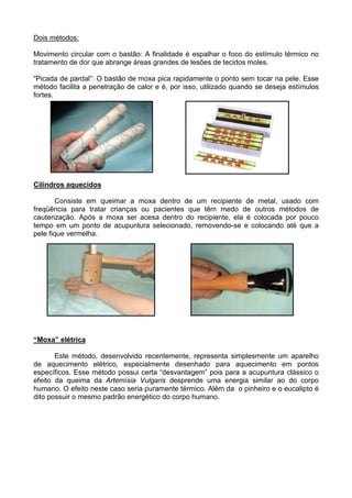 Dois métodos:
Movimento circular com o bastão: A finalidade é espalhar o foco do estímulo térmico no
tratamento de dor que abrange áreas grandes de lesões de tecidos moles.
“Picada de pardal”: O bastão de moxa pica rapidamente o ponto sem tocar na pele. Esse
método facilita a penetração de calor e é, por isso, utilizado quando se deseja estímulos
fortes.
Cilindros aquecidos
Consiste em queimar a moxa dentro de um recipiente de metal, usado com
freqüência para tratar crianças ou pacientes que têm medo de outros métodos de
cauterização. Após a moxa ser acesa dentro do recipiente, ela é colocada por pouco
tempo em um ponto de acupuntura selecionado, removendo-se e colocando até que a
pele fique vermelha.
“Moxa” elétrica
Este método, desenvolvido recentemente, representa simplesmente um aparelho
de aquecimento elétrico, especialmente desenhado para aquecimento em pontos
específicos. Esse método possui certa “desvantagem” pois para a acupuntura clássico o
efeito da queima da Artemísia Vulgaris desprende uma energia similar ao do corpo
humano. O efeito neste caso seria puramente térmico. Além da o pinheiro e o eucalipto é
dito possuir o mesmo padrão energético do corpo humano.
 