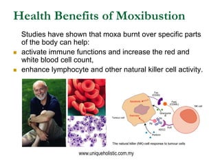 Health Benefits of Moxibustion
    Studies have shown that moxa burnt over specific parts
    of the body can help:
   activate immune functions and increase the red and
    white blood cell count,
   enhance lymphocyte and other natural killer cell activity.




                      www.uniqueholistic.com.my
 
