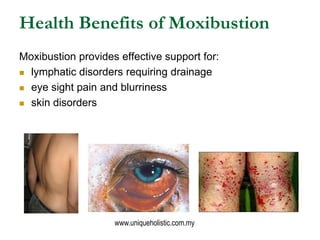 Health Benefits of Moxibustion
Moxibustion provides effective support for:
 lymphatic disorders requiring drainage

 eye sight pain and blurriness

 skin disorders




                    www.uniqueholistic.com.my
 