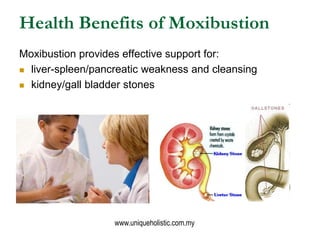 Health Benefits of Moxibustion
Moxibustion provides effective support for:
 liver-spleen/pancreatic weakness and cleansin...