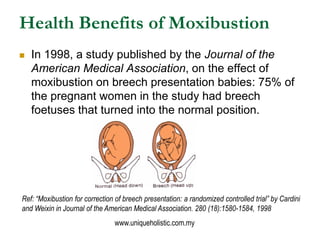 Health Benefits of Moxibustion
   In 1998, a study published by the Journal of the
    American Medical Association, on t...