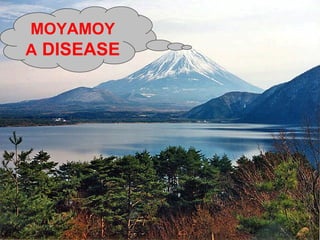 MOYAMOYA  DISEASE 
