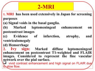 1. MRI has been used extensively in Japan for screening
purposes
(a) Signal voids in the basal ganglia.
(b) Marked leptomeningeal enhancement on
postcontrast images
(c) Evidence of infarction, atrophy, and
ventriculomegaly
(d) Hemorrhage
2. Ivy sign: Marked diffuse leptomeningeal
enhancement on postcontrast T1-weighted and FLAIR
images. Considered to represent the fine vascular
network over the pial surface.
 vivid contrast enhancement and high signal on FLAIR due
to slow flow.
2-MRI
 