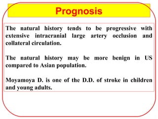 Prognosis
The natural history tends to be progressive with
extensive intracranial large artery occlusion and
collateral circulation.
The natural history may be more benign in US
compared to Asian population.
Moyamoya D. is one of the D.D. of stroke in children
and young adults.
 
