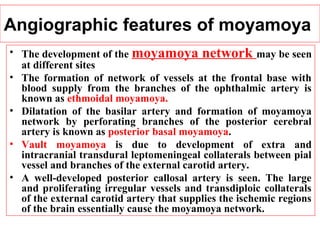 Angiographic features of moyamoya
• The development of the moyamoya network may be seen
at different sites
• The formation of network of vessels at the frontal base with
blood supply from the branches of the ophthalmic artery is
known as ethmoidal moyamoya.
• Dilatation of the basilar artery and formation of moyamoya
network by perforating branches of the posterior cerebral
artery is known as posterior basal moyamoya.
• Vault moyamoya is due to development of extra and
intracranial transdural leptomeningeal collaterals between pial
vessel and branches of the external carotid artery.
• A well-developed posterior callosal artery is seen. The large
and proliferating irregular vessels and transdiploic collaterals
of the external carotid artery that supplies the ischemic regions
of the brain essentially cause the moyamoya network.
 