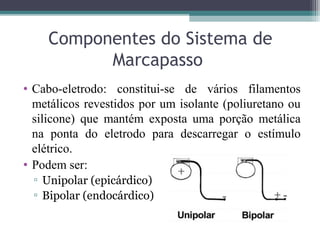 Componentes do Sistema de
Marcapasso
• Cabo-eletrodo: constitui-se de vários filamentos
metálicos revestidos por um isolante (poliuretano ou
silicone) que mantém exposta uma porção metálica
na ponta do eletrodo para descarregar o estímulo
elétrico.
• Podem ser:
▫ Unipolar (epicárdico)
▫ Bipolar (endocárdico)
 