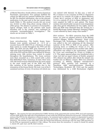 Gene expression analysis in the human hypothalamus 
S-S Wang et al 
of Mental Disorders, fourth edition criteria (American 
Psychiatric Association). Five patients fulfilled the 
criteria for MD and two patients fulfilled the criteria 
for BD. For detailed information, also on the relevant 
medication in the past and in the last month before 
death (Table 1). The medical records did not reveal 
any alcohol or other drug abuse among subjects of 
either group. The absence or presence of neuropatho-logical 
changes, both in the patients with mood 
disorders and in the controls, was confirmed by 
systematic neuropathological investigation.35 The 
results are set down in Table 1. 
Human brain material 
Laser microdissection. The freshly frozen hypo-thalami 
were serially sectioned at 15 1C on a 
cryostat (Leica CM 1850 UV) at a thickness of 20 mm 
from rostral to caudal throughout the PVN and the 
SON. The PVN and the SON were dissected at the 
right side of the hypothalamus. The beginning and the 
end of the PVN and the SON were defined by thionin 
staining every 10th section from rostral to caudal 
throughout the hypothalamus. The tissue sections 
were thaw mounted on a slide coated with a plain 
film (Birkelbach Film, Germany). In total, there were 
126–328 serial sections obtained from the most rostral 
to the most caudal part of the SON and PVN 
(the variation of the section numbers due to the 
orientation of the frozen block). We took 3 out of the 9 
unstained sections of every 10 sections (of which one 
was stained with thionin). In this way, a total of 
66±3 (mean±s.e.m.) sections of PVN in depression 
and 64±8 in controls (P = 0.304 in Mann–Whitney 
U-test); 60±3 sections of SON in depression and 
51±4 in controls (P = 0.14 in Mann–Whitney U-test) 
were sampled for LMD in each patient. The frozen 
sections were stored under vacuum at room temperature 
with silica gel for dehydration for two nights, and the 
PVN and SON were dissected from the sections by a 
PALM MicroLaser System (Bernried, Germany) (Figure 
1) and collected by hand, using a fine needle.36 
RNA isolation. For RNA extraction from the LMD 
tissue, we used an adapted protocol of the RNeasy 
protocol (Qiagen, Hilden, Germany). Trizol (1 ml) 
(Invitrogen Life Technologies, Carlsbad, CA, USA) 
was added to the vial containing all the dissected 
material of the PVN or SON of one patient. After 
spinning down at 12 000 g for 10 min at 4 1C, the 
supernatant was transferred into another tube; 200 ml 
chloroform was added to the supernatant, vortexed 
for 15 sec and centrifuged for 15 min at 12 000 g at 
4 1C. The upper aqueous phase was transferred into a 
clean vial and an equal volume of freshly prepared 
70% ethanol was added, after which the sample was 
loaded onto an RNeasy column. RNA was extracted 
according to RNeasy (Qiagen) manufacturer’s 
protocol. RNA quantity was measured on a 
NanoDrop 1000 spectrophotometer (NanoDrop 
Technologies, Rockland, DE, USA) and the quality 
was determined by a 2100 BioAnalyzer (Agilent 
Figure 1 The sections for laser microdissection (LMD). Sections of the paraventricular nucleus (PVN, a–c) and supraoptic 
nucleus (SON, d–f) at the right side of hypothalamus as seen under the PALM laser-dissection microscope. A thionin-stained 
section of the PVN for the orientation is shown in panel a. An unstained section adjacent to panel a is represented in panel b 
before LMD, in which the PVN area is outlined under the microscope. The section b is represented in panel c after laser 
dissection. The sections of the right SON under the PALM laser-dissection microscope with the same LMD procedure as 
for the PVN are represented in panels d–f. Bar = 300 mm. The arrows show the orientation: V, ventral; D, dorsal; M, medial; 
L, lateral; OT, optic tract; and III, third ventricle. 
790 
Molecular Psychiatry 
 