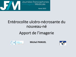 Entérocolite  ulcéro-­‐nécrosante  du  
nouveau-­‐né  
  
Apport  de  l’imagerie
	
  
Michel	
  PANUEL	
  
Hanoi	
  2015	
  
 