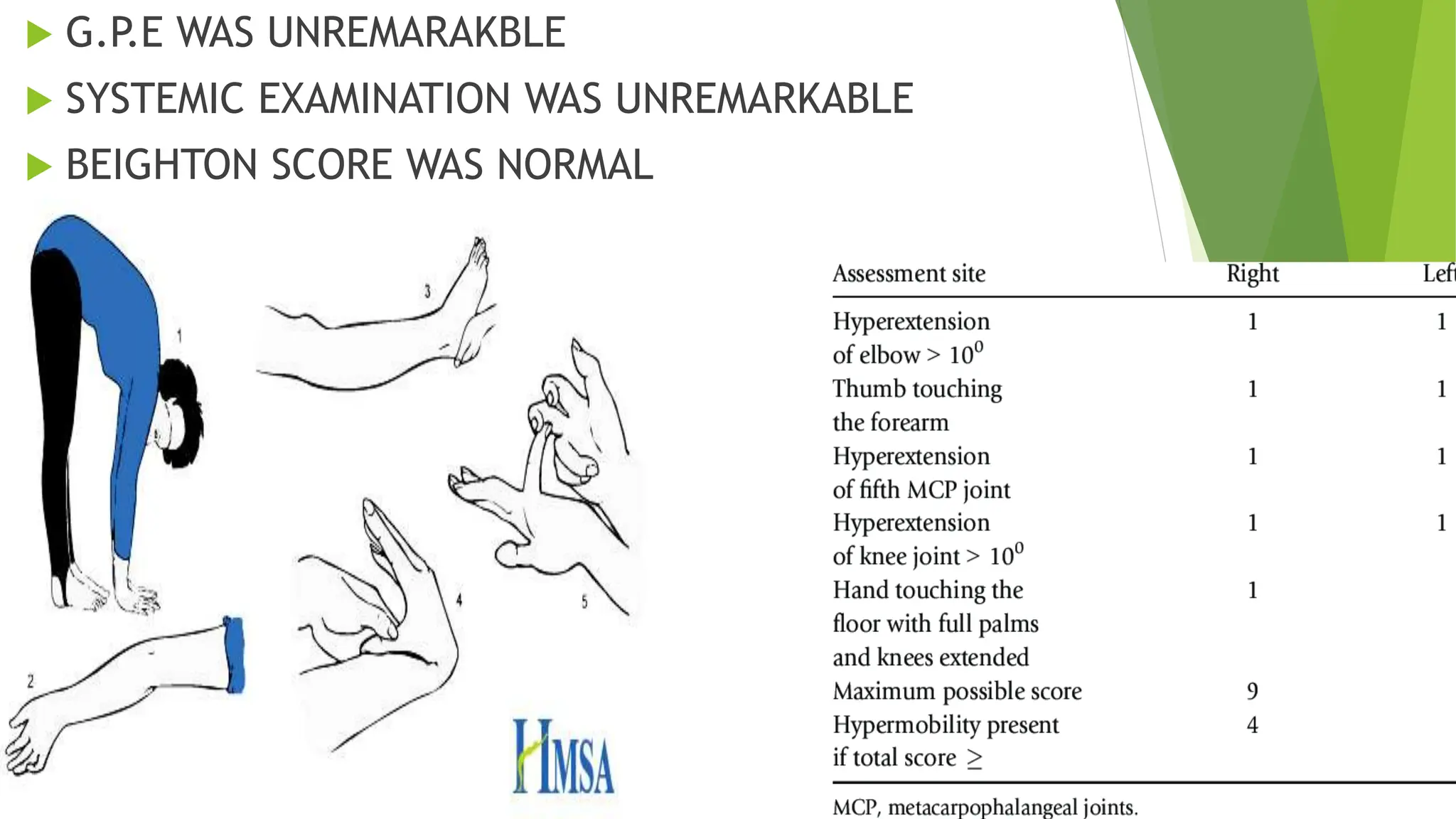 Medial Patello Femoral Ligament MPFL Reconstruction PPTX
