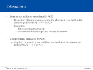 S L I D E 21
Pathogenesis
• Immunocomplexes-associated MPGN
– Deposition of immunocomplexes in the glomeruli -> activation the
classical pathway (CP) ->->-> MPGN
– Examples:
• Infections: Hepatitis C and B
• Autoimmune diseases: lupus and rheumatoid arthritis
• Complement-mediated MPGN
– Acquired or genetic abnormalities -> activation of the alternative
pathway (AP) ->->-> MPGN
 