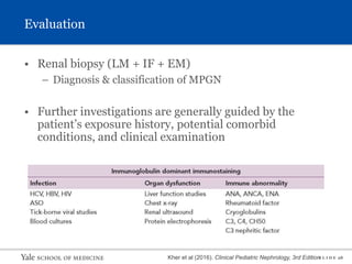 S L I D E 28
Evaluation
• Renal biopsy (LM + IF + EM)
– Diagnosis & classification of MPGN
• Further investigations are generally guided by the
patient’s exposure history, potential comorbid
conditions, and clinical examination
Kher et al (2016). Clinical Pediatric Nephrology, 3rd Edition
 