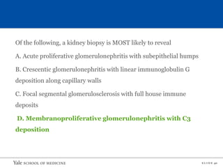 S L I D E 40
Of the following, a kidney biopsy is MOST likely to reveal
A. Acute proliferative glomerulonephritis with subepithelial humps
B. Crescentic glomerulonephritis with linear immunoglobulin G
deposition along capillary walls
C. Focal segmental glomerulosclerosis with full house immune
deposits
D. Membranoproliferative glomerulonephritis with C3
deposition
 
