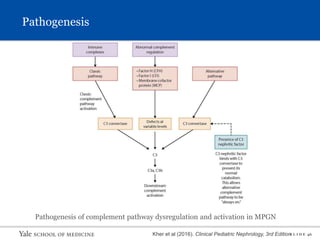 S L I D E 46
Pathogenesis of complement pathway dysregulation and activation in MPGN
Kher et al (2016). Clinical Pediatric Nephrology, 3rd Edition
Pathogenesis
 