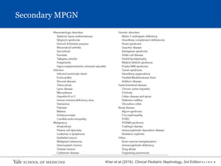 S L I D E 8
Secondary MPGN
Kher et al (2016). Clinical Pediatric Nephrology, 3rd Edition
 