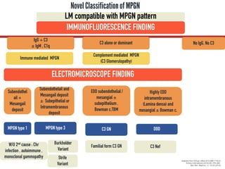 Novel Classificationof MPGN
IMMUNOFLUORESCENCE FINDING
IgG + C3
± IgM , C1q
C3 alone or dominant
Immune mediated MPGN
Complement mediated MPGN
(C3 Glomerulopathy)
ELECTROMICROSCOPE FINDING
Subendothel
ail +
Mesangail
deposit
Highly EDD
intramembranous
(Lamina densa) and
mesangial ± Bowman c,
MPGN type 1
Subendothelail and
Mesangail deposit
± Subepithelial or
Intramembranous
deposit
MPGN type 3 DDD
EDD subendothelial /
mesangial ±
subepithelium ,
Bowman c,TBM
C3 GN
Burkholder
Variant
Strife
Variant
W/U 2nd cause : Chr
infection , autoimmune ,
monoclonal gammopathy
Familial form C3 GN
Adapted from N Engl J Med 2012;366:1119-31
Kidney International (2016) 89, 278–288.
Nat. Rev. Nephrol. 11, 14–22 (2015)
LM compatible with MPGN pattern
No IgG, No C3
C3 Nef
 