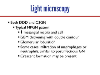 Light microscopy
§ Both DDD and C3GN
§ Typical MPGN patern
§ ⬆ mesangial matrix and cell
§ GBM thickening with double contour
§ Glomerular lobulation
§ Some cases infiltration of macrophages or
neutrophils. Similar to postinfectious GN
§ Crescent formation may be present
 