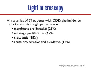 § In a series of 69 patients with DDD, the incidence
of di erent histologic patterns was
§ membranoproliferative (25%)
§ mesangioproliferative (45%)
§ crescentic (18%)
§ acute proliferative and exudative (12%)
Light microscopy
N Engl J Med 2012;366:1119-31.
 