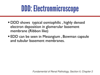 DDD: Electronmicroscope
§ DDD shows typical osmiophilic , highly densed
electron deposition in glomerular basement
membrane (Ribbon like)
§ EDD can be seen in Mesangium , Bowman capsule
and tubular basement membranes.
Fundamental of Renal Pathology, Section II, Chapter 2
 