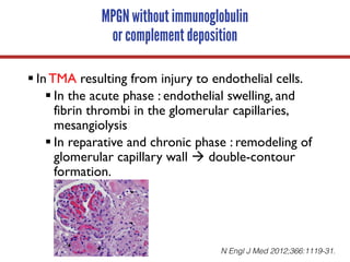 MPGN without immunoglobulin
or complement deposition
§ In TMA resulting from injury to endothelial cells.
§ In the acute phase : endothelial swelling, and
fibrin thrombi in the glomerular capillaries,
mesangiolysis
§ In reparative and chronic phase : remodeling of
glomerular capillary wall à double-contour
formation.
N Engl J Med 2012;366:1119-31.
 