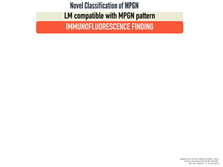 Novel Classificationof MPGN
IMMUNOFLUORESCENCE FINDING
Adapted from N Engl J Med 2012;366:1119-31
Kidney International (2016) 89, 278–288.
Nat. Rev. Nephrol. 11, 14–22 (2015)
LM compatible with MPGN pattern
 