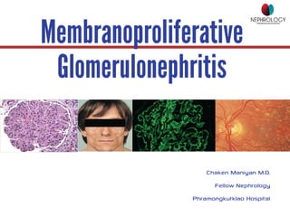 Membranoproliferative
Glomerulonephritis
Chaken Maniyan M.D.
Fellow Nephrology
Phramongkutklao Hospital
 