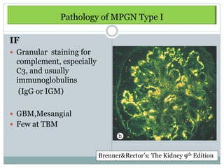 Pathology of MPGN Type I

IF
 Granular staining for
 complement, especially
 C3, and usually
 immunoglobulins
  (IgG or IGM)

 GBM,Mesangial
 Few at TBM



                          Brenner&Rector’s: The Kidney 9th Edition
 