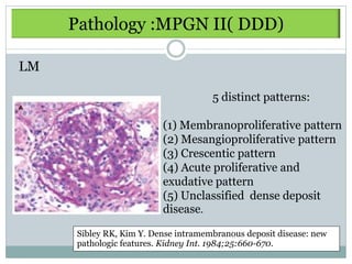 Pathology :MPGN II( DDD)

LM

                                     5 distinct patterns:

                         (1) Membranoproliferative pattern
                         (2) Mesangioproliferative pattern
                         (3) Crescentic pattern
                         (4) Acute proliferative and
                         exudative pattern
                         (5) Unclassified dense deposit
                         disease.

     Sibley RK, Kim Y. Dense intramembranous deposit disease: new
     pathologic features. Kidney Int. 1984;25:660-670.
 