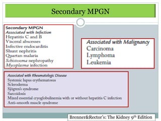 Secondary MPGN




    Brenner&Rector’s: The Kidney 9th Edition
 