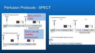 Perfusion Protocols - SPECT
Not a K/C/O
CAD
K/C/O old MI,
Viability
Assessment
 
