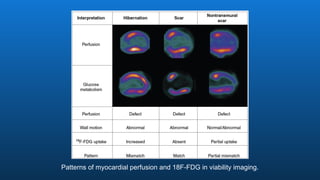 Patterns of myocardial perfusion and 18F-FDG in viability imaging.
 