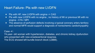 Heart Failure- Pts with new LVDFN
● Pts with HF, new LVDFN with angina -> CAG
● Pts with new LVDFN with no angina , no history of MI or previous MI with no
angina - CTA / MPI
● The absence of perfusion defects involving a typical coronary artery territory
and normal MFR would support a diagnosis of nonischemic cardiomyopathy
Case -4 :
74-year- old woman with hypertension, diabetes, and chronic kidney dysfunction
who presented with new-onsetexertional dyspnea.
The ECG showed left bundle branch block (LBBB).
 