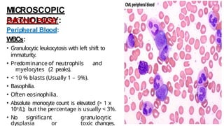 MICROSCOPIC
PATHOLOGY:
CHRONIC PHASE:
Peripheral Blood:
WBCs:
• Granulocytic leukocytosis with left shift to
immaturity.
• Predominance of neutrophils and
myelocytes (2 peaks).
• < 10 % blasts (Usually 1 – 9%).
• Basophilia.
• Often eosinophilia.
• Absolute monocyte count is elevated (> 1 x
109/L); but the percentage is usually < 3%.
• No significant granulocytic
dysplasia or toxic changes.
 
