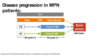 Disease progression in MPN
patients:
 
