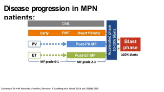 Disease progression in MPN
patients:
 