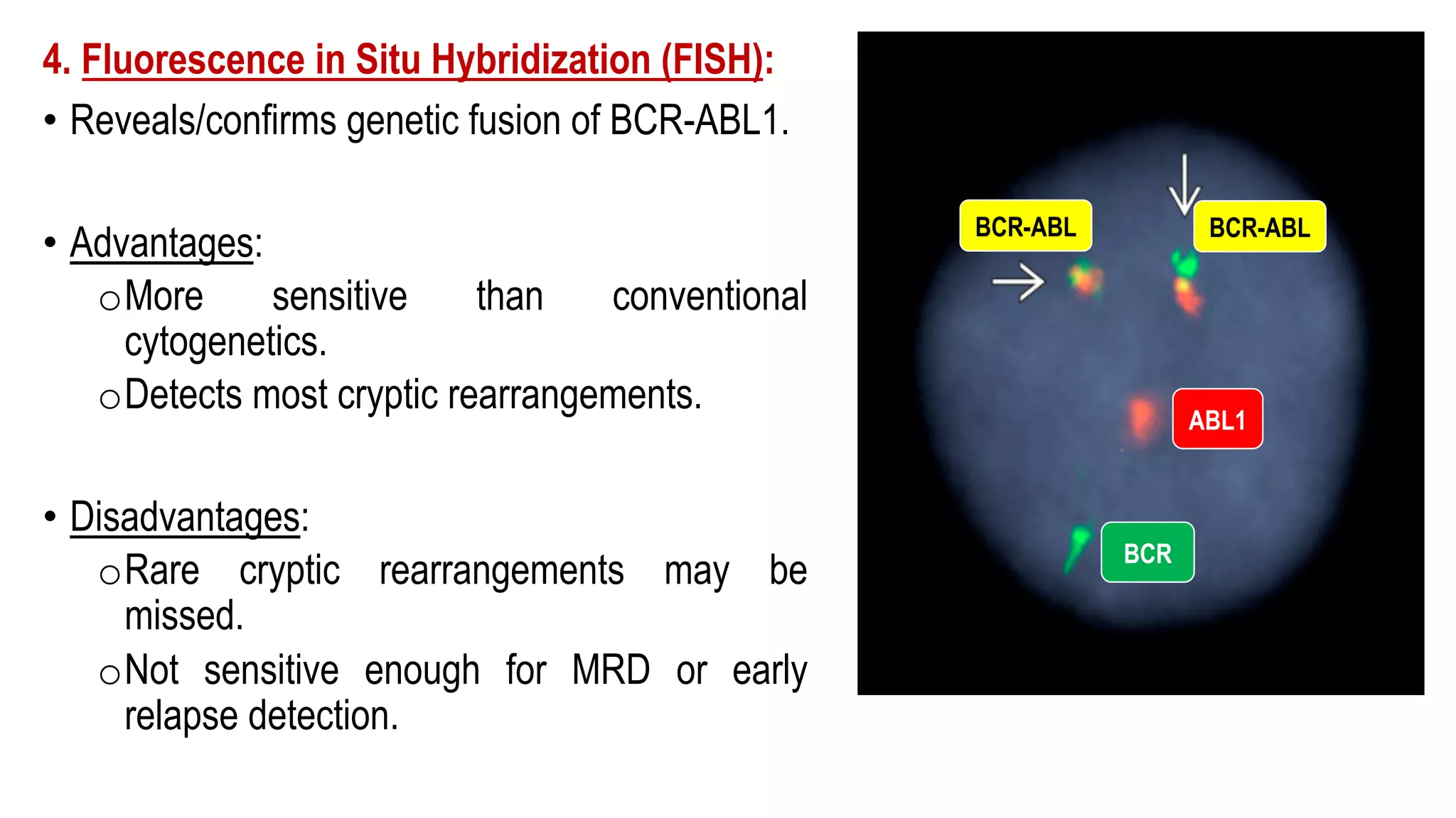 4. Fluorescence in Situ Hybridization (FISH):
• Reveals/confirms genetic fusion of BCR-ABL1.
• Advantages:
oMore sensitive than conventional
cytogenetics.
oDetects most cryptic rearrangements.
• Disadvantages:
oRare cryptic rearrangements may be
missed.
oNot sensitive enough for MRD or early
relapse detection.
BCR
ABL1
BCR-ABL
BCR-ABL
 