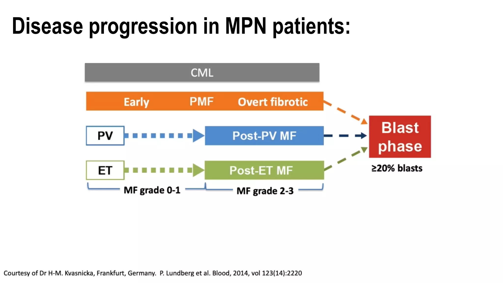 Disease progression in MPN patients:
 