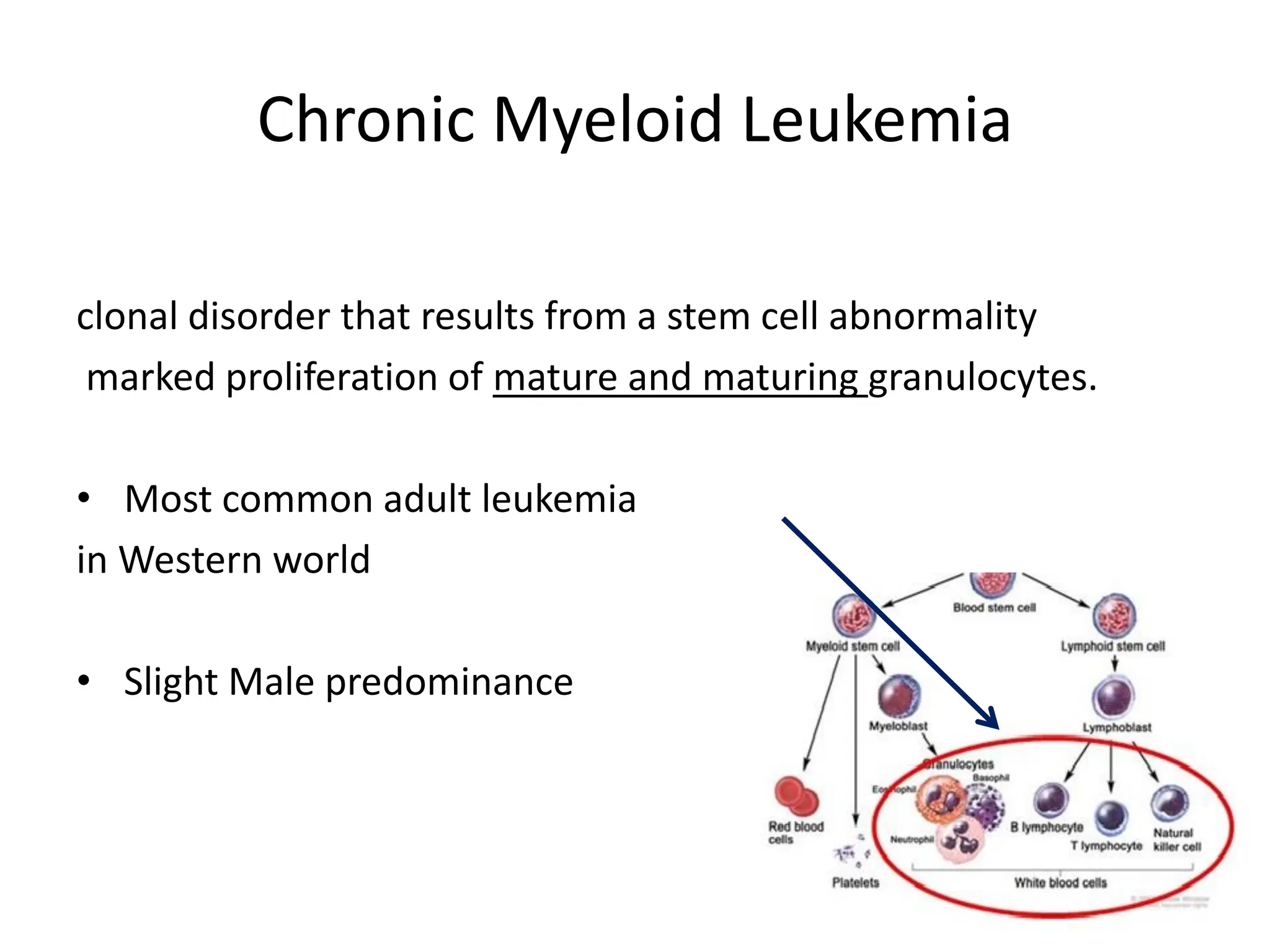 Chronic Myeloid Leukemia
clonal disorder that results from a stem cell abnormality
marked proliferation of mature and maturing granulocytes.
• Most common adult leukemia
in Western world
• Slight Male predominance
 