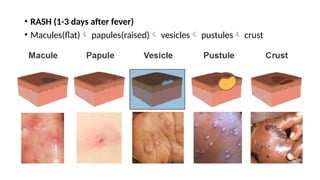 M pox/ Monkey pox - a public health emergency of international concern ...