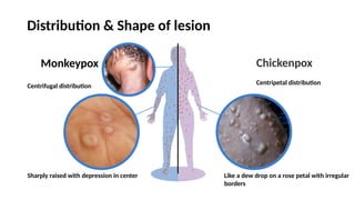 M pox/ Monkey pox - a public health emergency of international concern ...