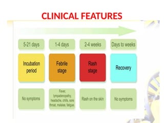 CLINICAL FEATURES
 