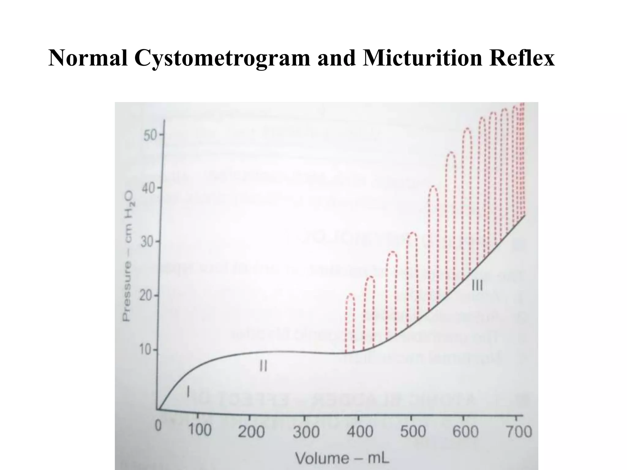 Normal Cystometrogram and Micturition Reflex
 