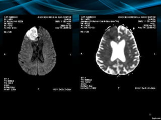 Neuroimaging | PPTX