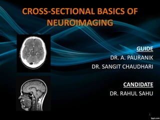CROSS-SECTIONAL BASICS OF
NEUROIMAGING
GUIDE
DR. A. PAURANIK
DR. SANGIT CHAUDHARI
CANDIDATE
DR. RAHUL SAHU
1
 