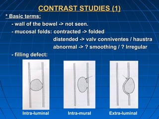 Imaging of the abdomen & the gastrointestinal | PPT