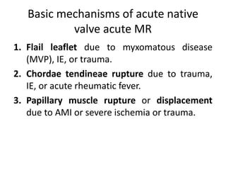 Basic mechanisms of acute native
valve acute MR
1. Flail leaflet due to myxomatous disease
(MVP), IE, or trauma.
2. Chordae tendineae rupture due to trauma,
IE, or acute rheumatic fever.
3. Papillary muscle rupture or displacement
due to AMI or severe ischemia or trauma.
 